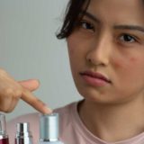 肌荒れとニキビを予防するために大切なこと