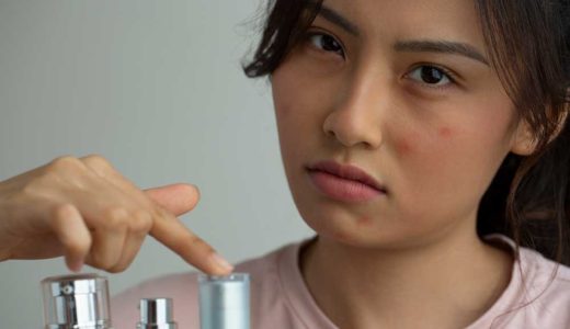 肌荒れとニキビを予防するために大切なこと